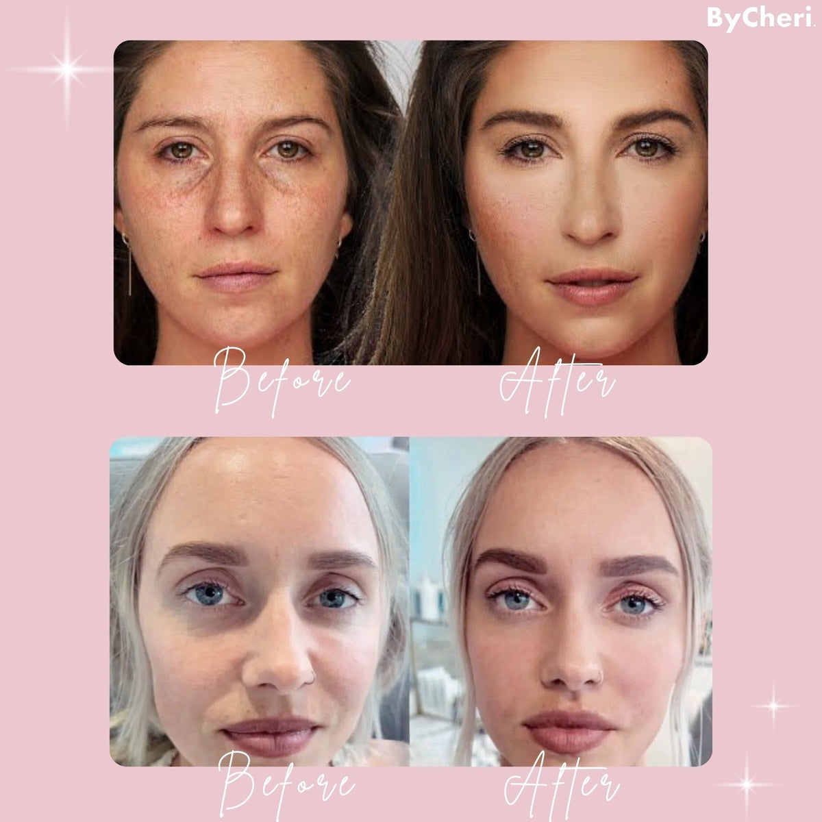 1 + 1 GRATIS HEUTE | GlowGaze™ | Augenringe Aufheller