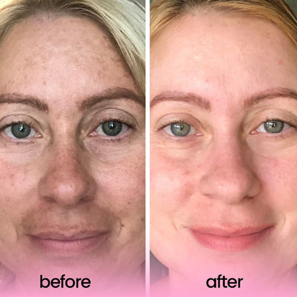 1 + 1 GRATIS HEUTE | GlowZest™ | Strahlendere Haut in nur einer Anwendung!