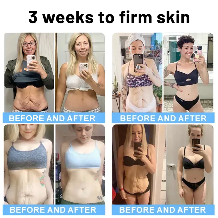 1 + 1 GRATIS HEUTE | RevitaStick™ | Ihr Geheimnis für straffere, elastischere Haut!