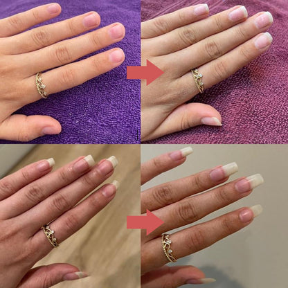 1+1 GRATIS | Nails Nutritious Growth Oil™ – Entfalte stärkere, gesündere Nägel, die bei jeder Berührung glänzen