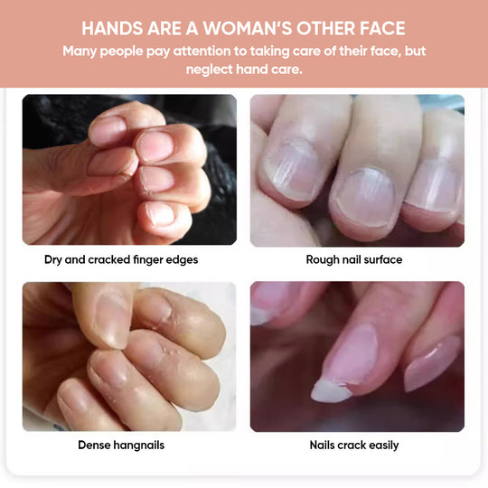 1+1 GRATIS | Nails Nutritious Growth Oil™ – Entfalte stärkere, gesündere Nägel, die bei jeder Berührung glänzen