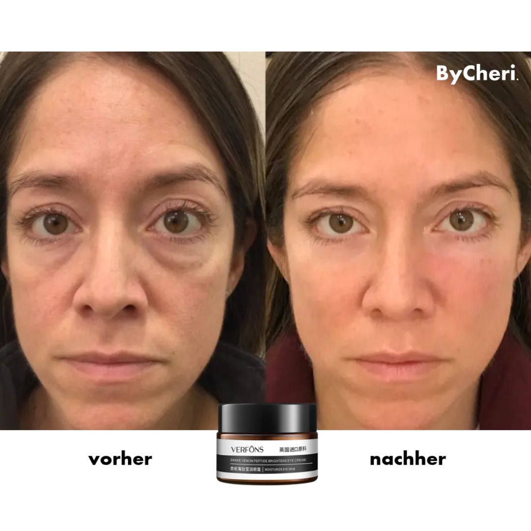 1+1 GRATIS TEMPORÄR | EyeRejuv™- Faltenentfernende Augencreme!