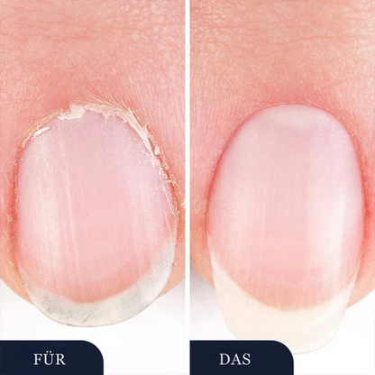 StrongNail – Präzise Nagelpflege | 1+1 GRATIS