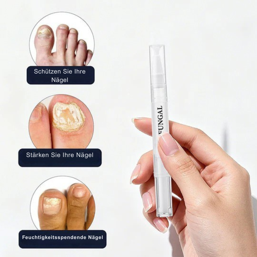StrongNail – Präzise Nagelpflege | 1+1 GRATIS