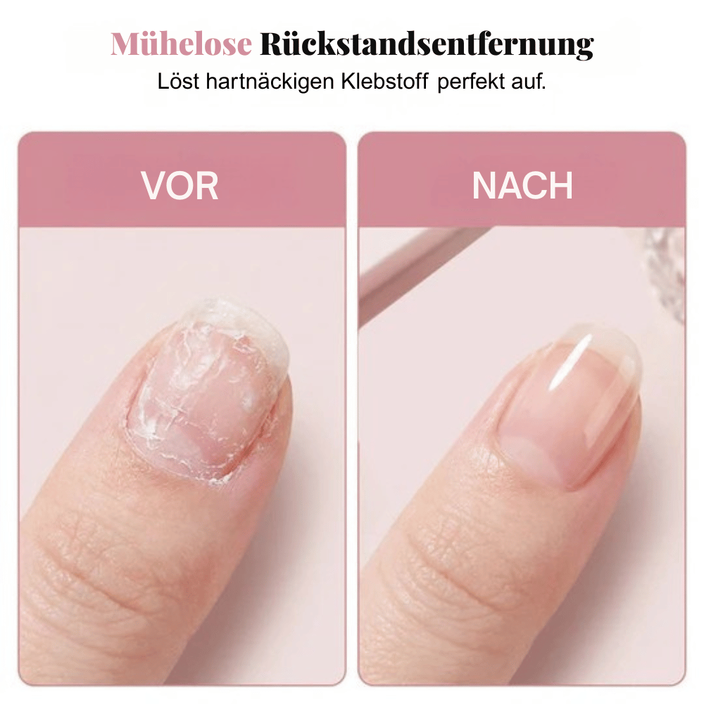 MistEase — Nagellöser Spray für Nägel | 1+1 GRATIS