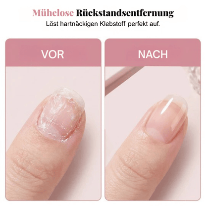 MistEase — Nagellöser Spray für Nägel | 1+1 GRATIS