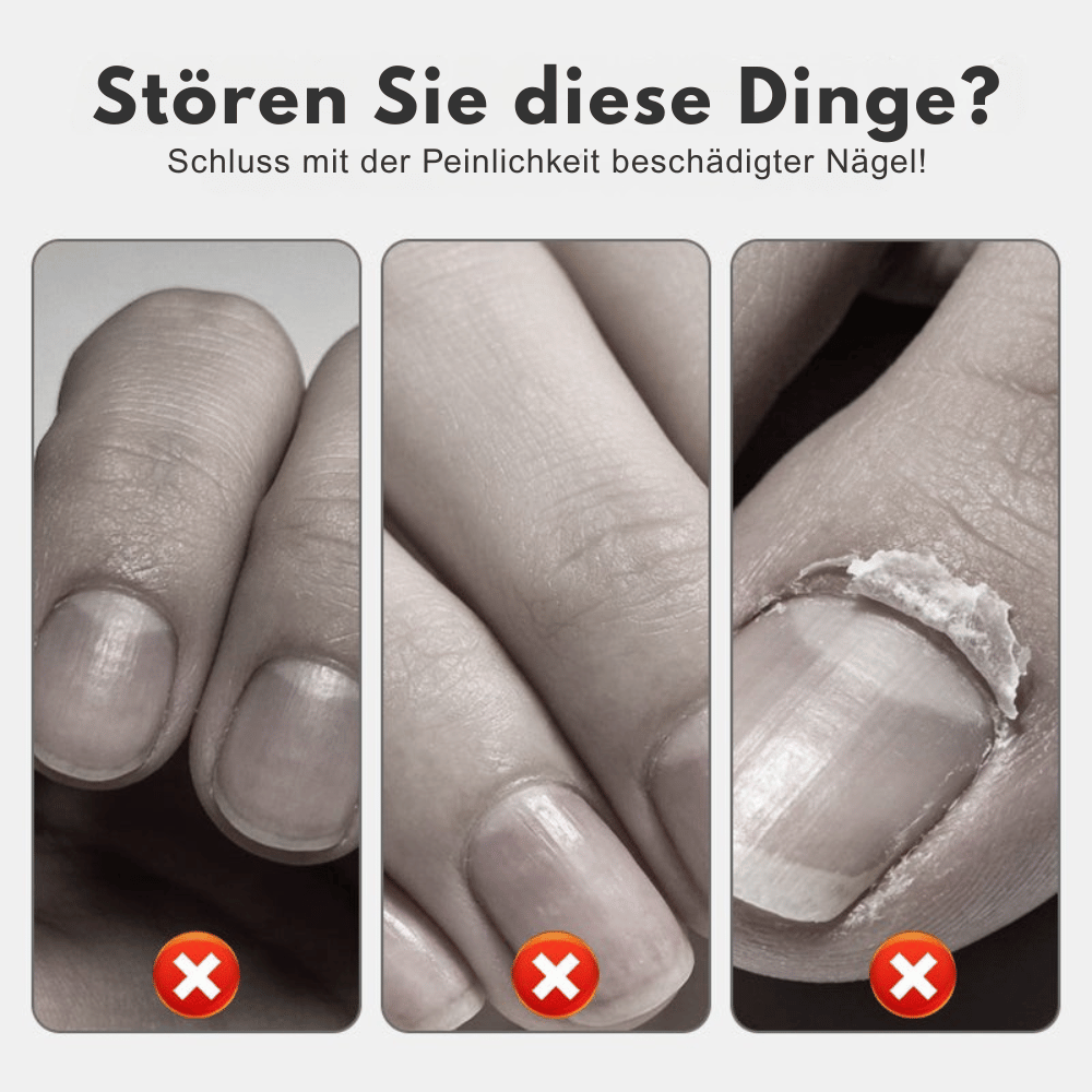 NailRevive – Stärkendes Nagelspray | 1+1 GRATIS