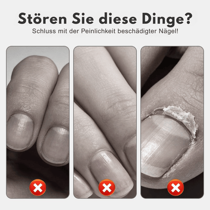 NailRevive – Stärkendes Nagelspray | 1+1 GRATIS