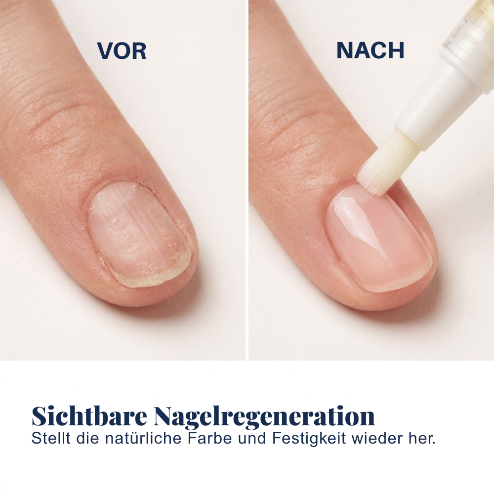 Nail Recovery — Nagelpflege-Stift-Set | 1+1 GRATIS