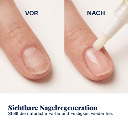 Nail Recovery — Nagelpflege-Stift-Set | 1+1 GRATIS