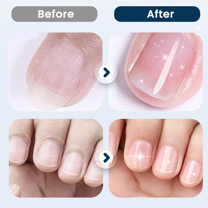 NailRevive – Stärkendes Nagelspray | 1+1 GRATIS
