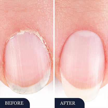 StrongNail – Präzise Nagelpflege | 1+1 GRATIS