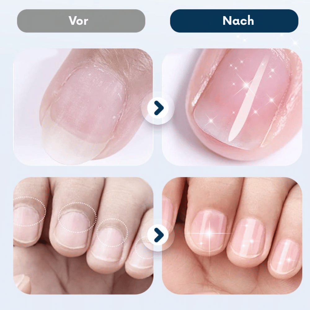 NailRevive – Stärkendes Nagelspray | 1+1 GRATIS