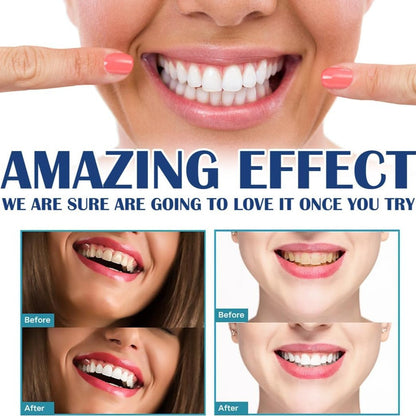 BrightSmile™ Zahnaufhellungs-Stift | 1+1 GRATIS