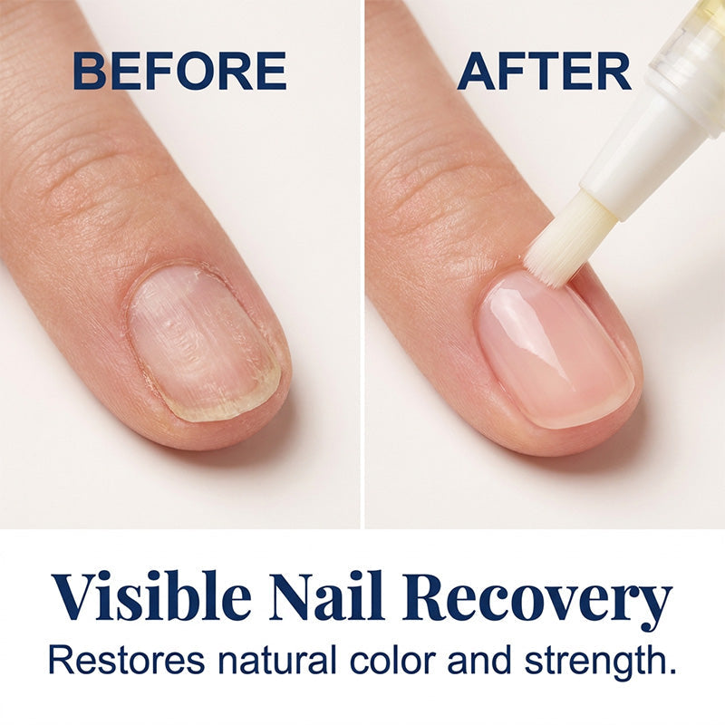 Nail Recovery — Nagelpflege-Stift-Set | 1+1 GRATIS