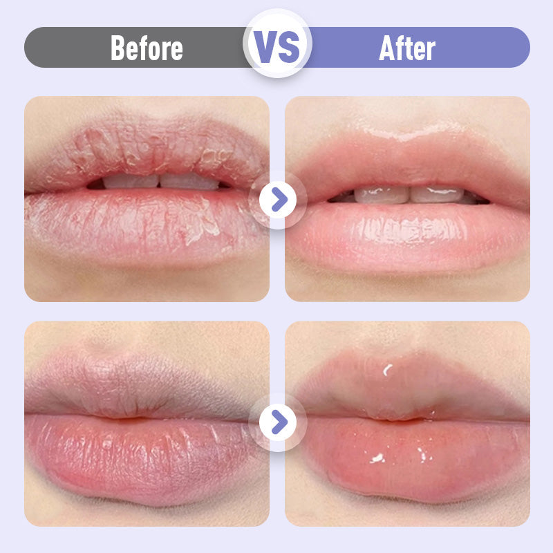 LushVive – Aufpolsterndes Lippenserum | 1+1 GRATIS
