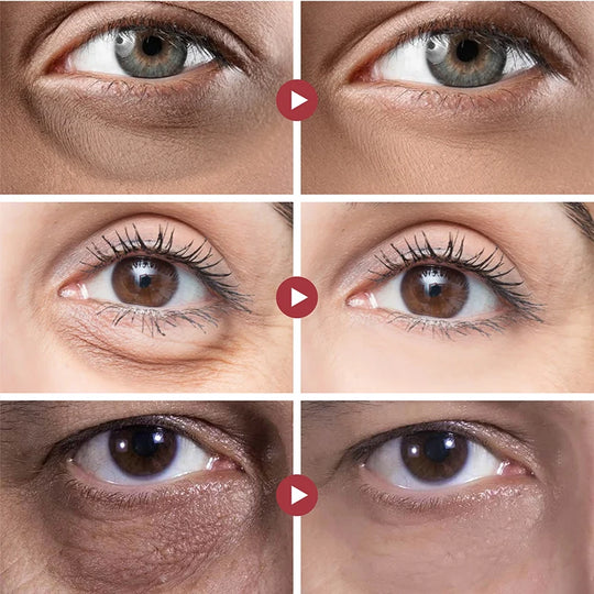 Augencreme | Anti-aging Moisturizing | Against Wrinkles & Dark Circles | LumiVéa