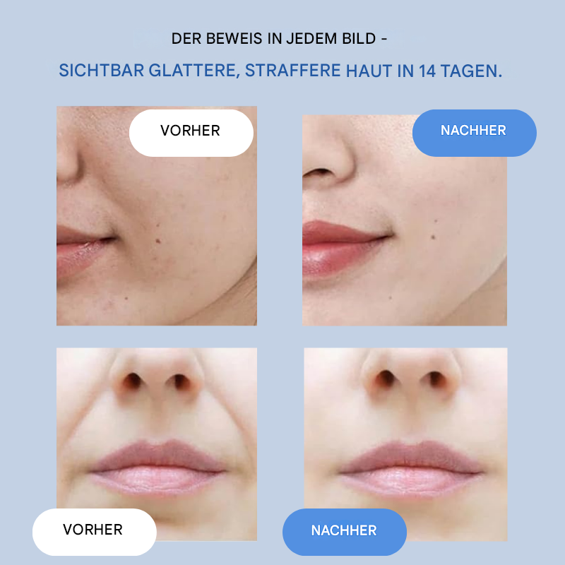Lifting Gesichtsstreifen | Sofort Glätten & Straffen | Anti-Falten Pflege ohne OP | YouthLift Renew