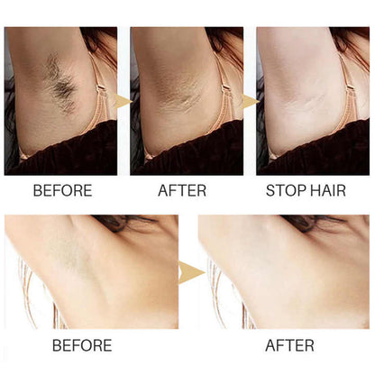 Smoothify™ Haarentfernungs-Serum | Dauerhaft & Schmerzfrei | 1+1 Gratis