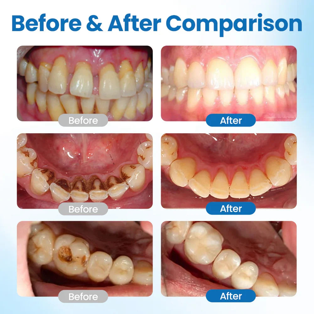 Zahnpflege | Zahnschutzserum | Weniger empfindliche Zähne | ToothArmor
