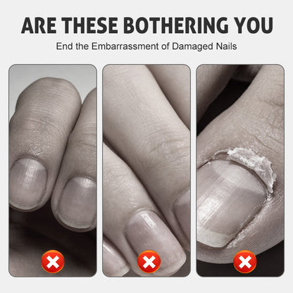 NailRevive – Stärkendes Nagelspray | 1+1 GRATIS