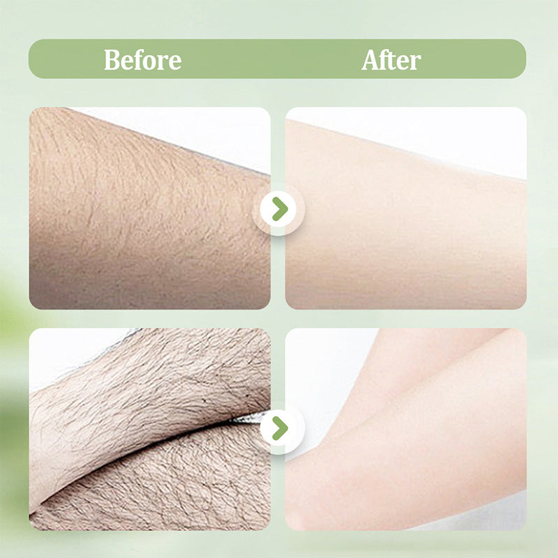 SilkPure 250 g — Sanfte Enthaarungscreme | 1+1 GRATIS