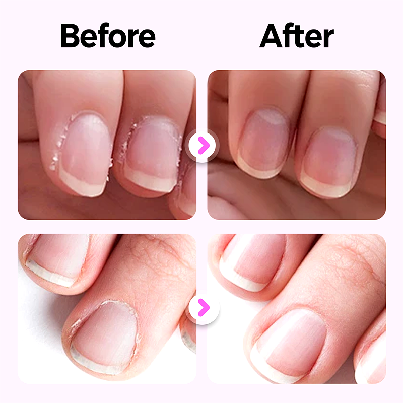 NailÉlixir – Duftender Nagelpflege Stift | 1+2 GRATIS