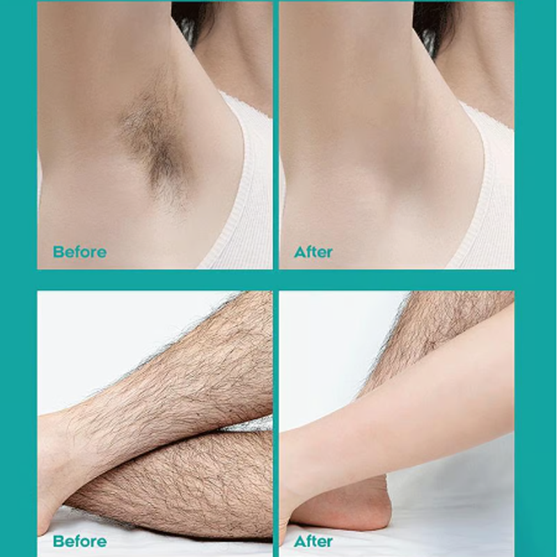 SilkenEase — Sanfte Haarentfernung Creme | 1+1 GRATIS