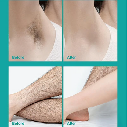SilkenEase — Sanfte Haarentfernung Creme | 1+1 GRATIS