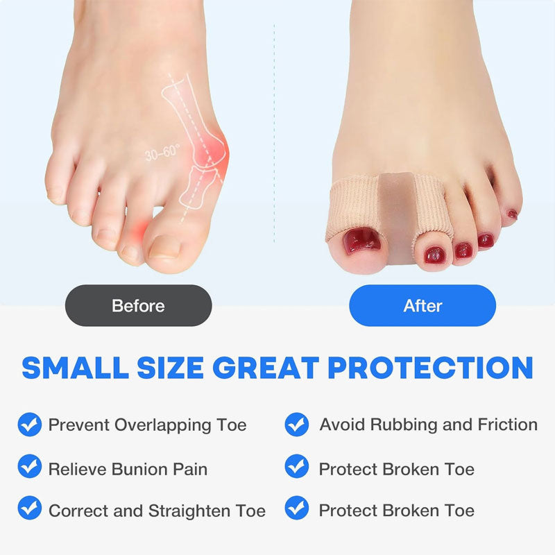 FlexiStep – Sanfte Zehenkorrektur | 1+1 GRATIS