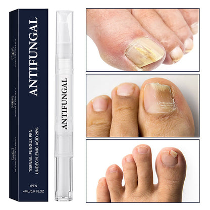 StrongNail – Präzise Nagelpflege | 1+1 GRATIS