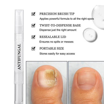 StrongNail – Präzise Nagelpflege | 1+1 GRATIS