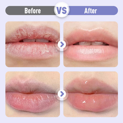 LumiLips – Aufpolsterndes & Anti-Falten Lippenserum | 1+2 GRATIS