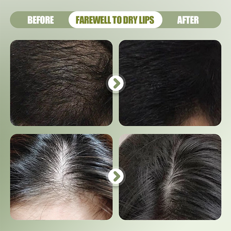 BotaniCare – Natürliches Haarstärkungs-Shampoo | 1+1 GRATIS